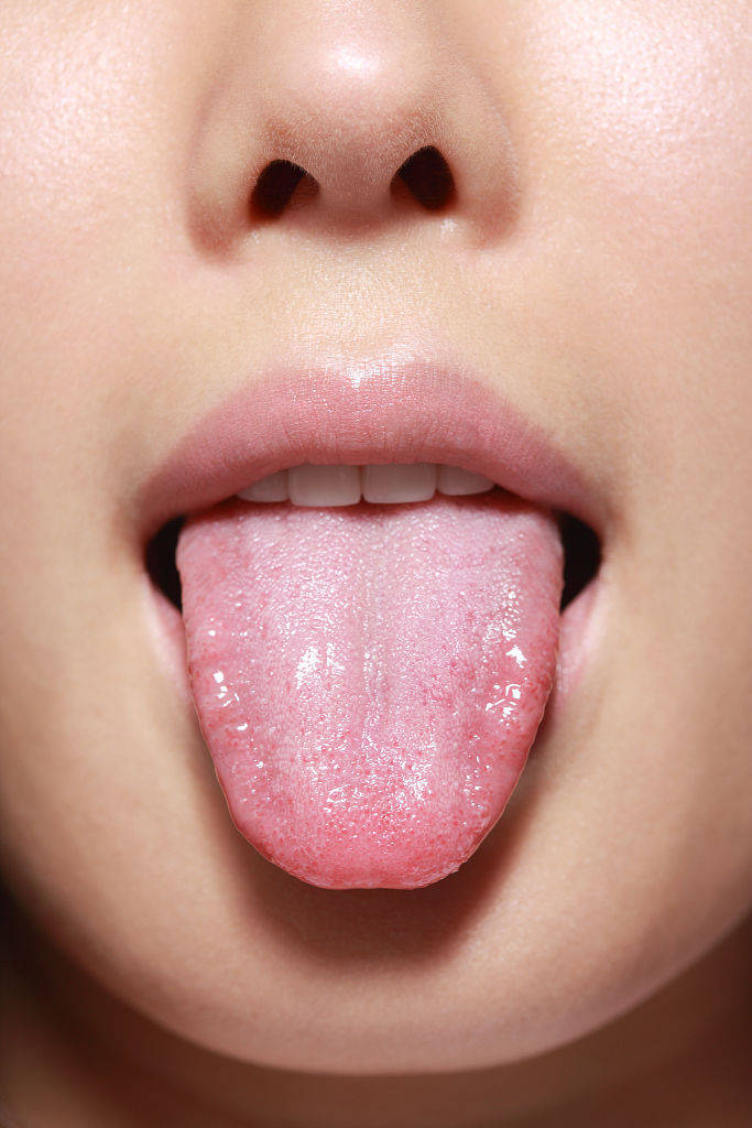 正常人的舌头图片
