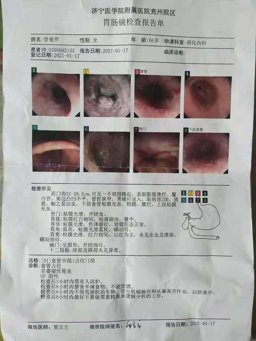 食道癌活检报告图片图片