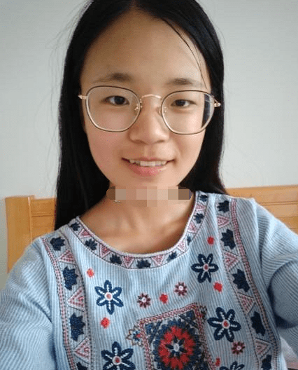 斗鸡眼,性格不好,为人自我,性格固执,占有欲强_面相