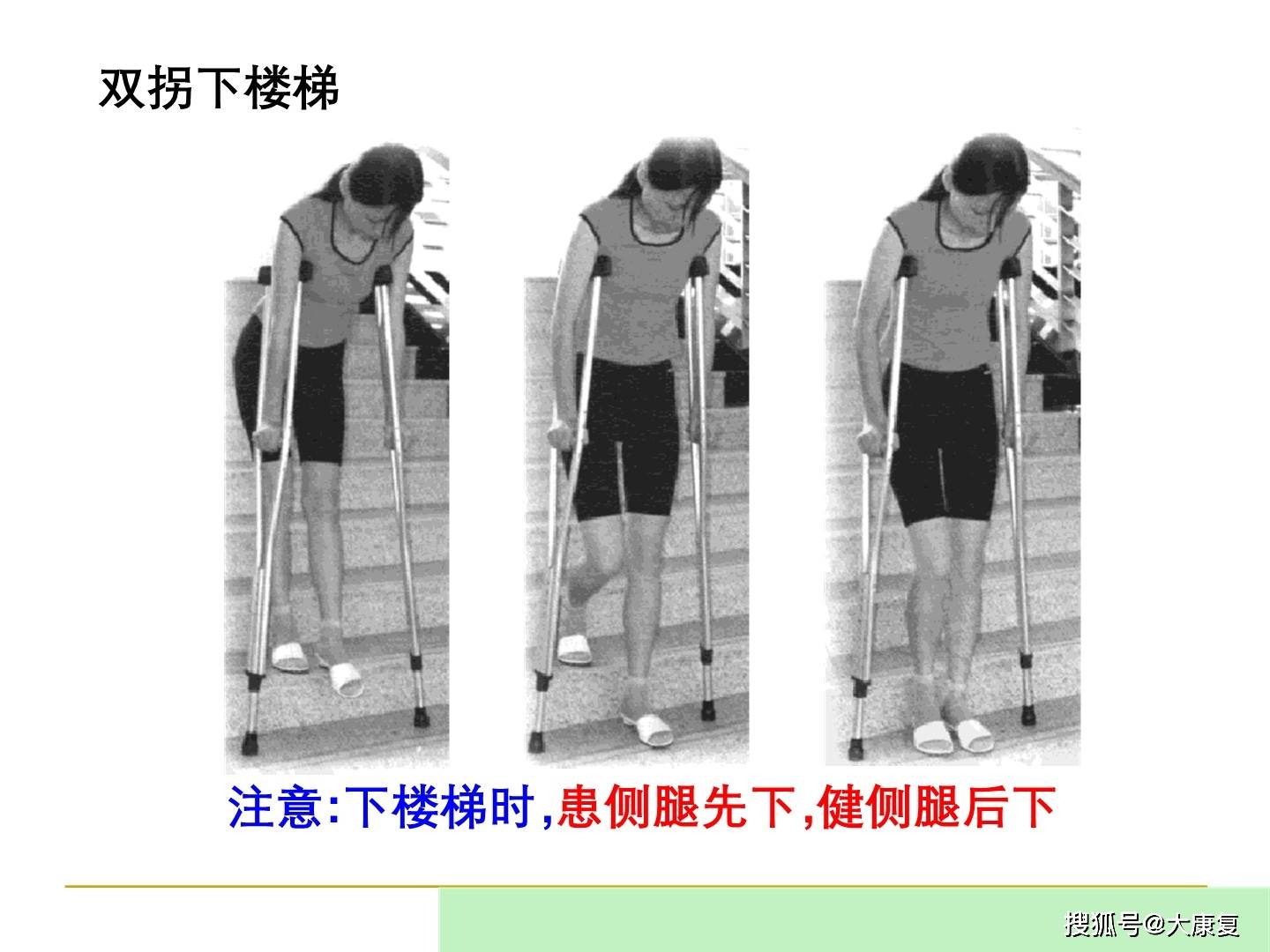 股骨颈骨折康复