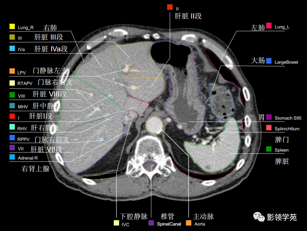 腹部影像学解剖图谱,拿走不谢!