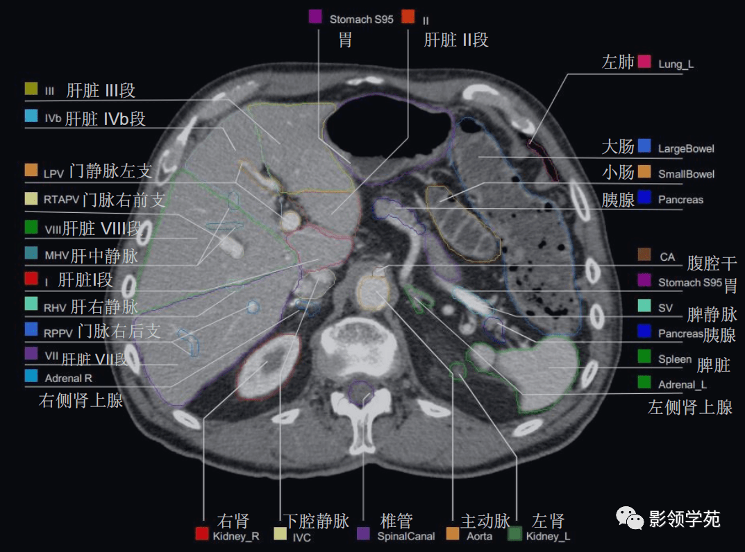 腹部影像学解剖图谱,拿走不谢!