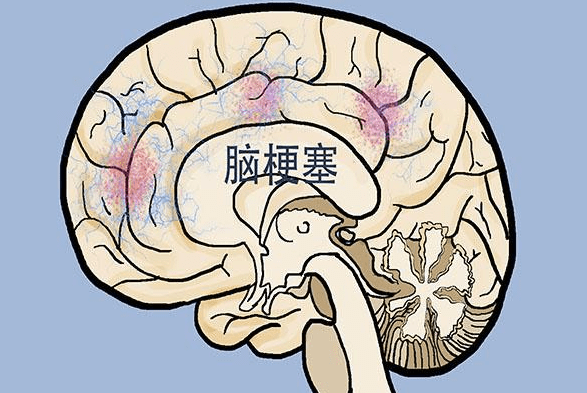 e8f65cb43a7143059d5c901f235a71fc.png