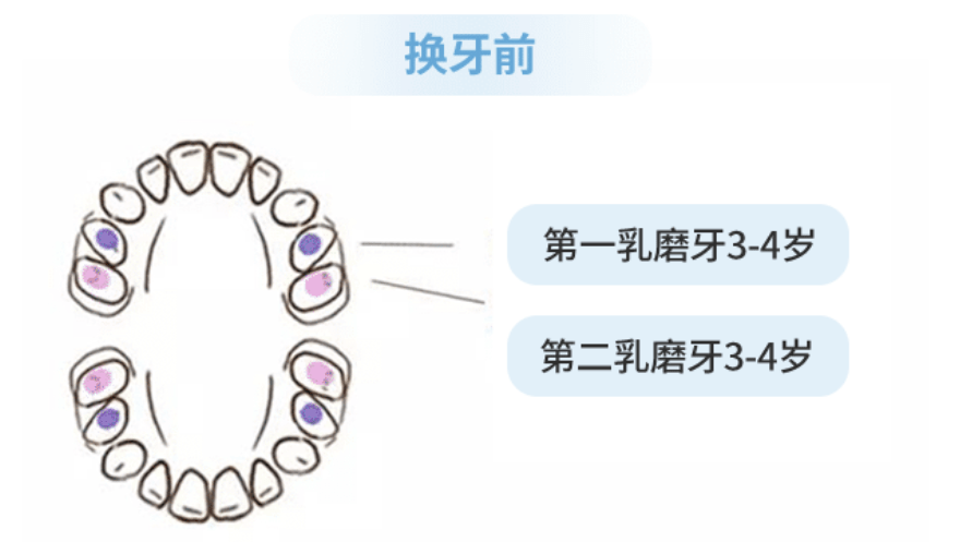 第二次,差不多是在6-8歲第一恆磨牙(六齡牙)萌出時.