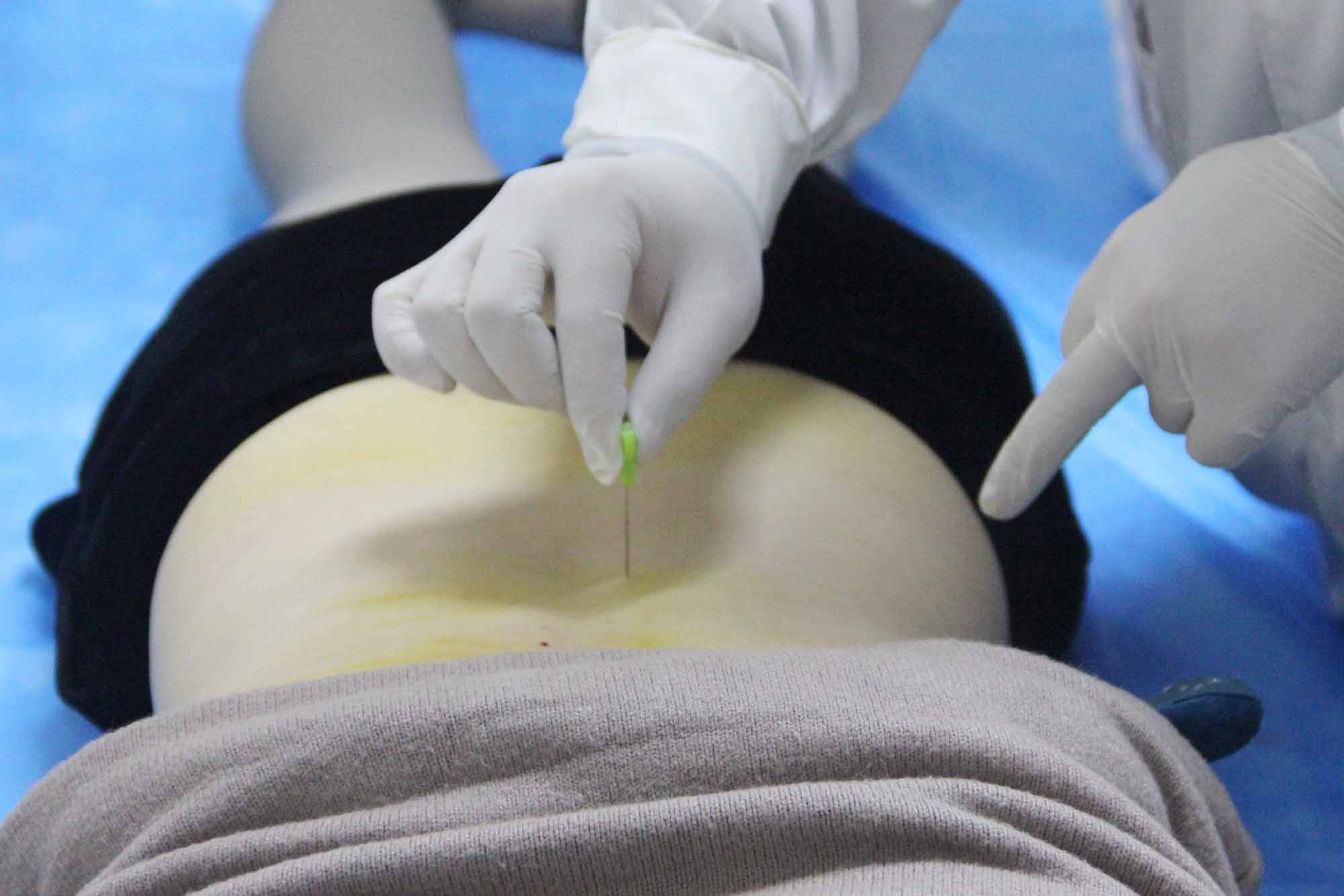 针刀疗法再显奇效静安医院康复科收到2021年第一面锦旗