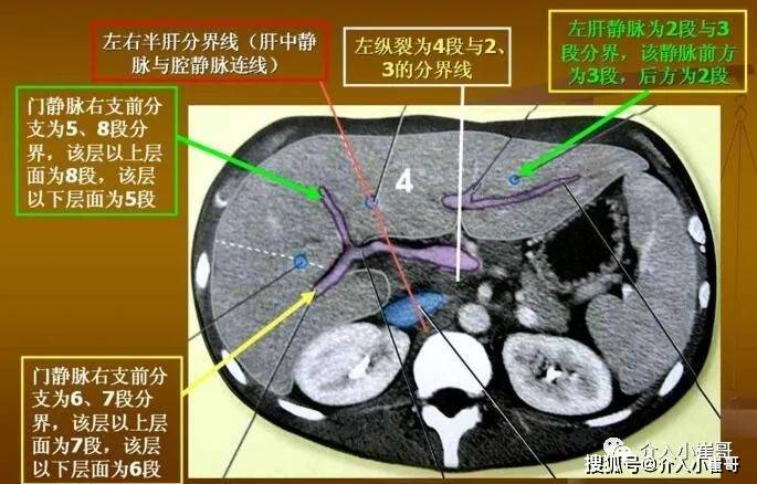 我们大致了解,s1和s4在肝脏的中间,s2和s3在肝脏的左边,s8在肝的右