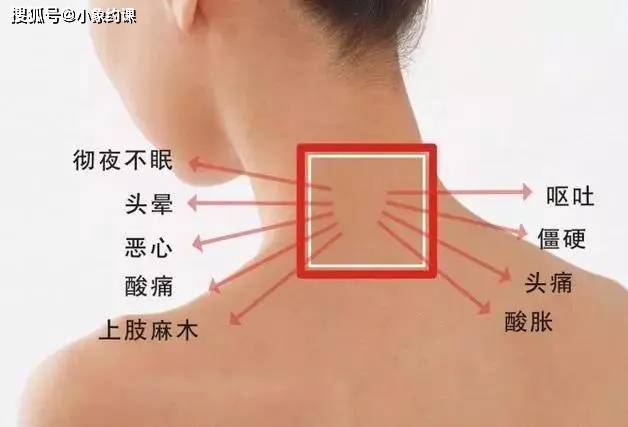 怎么能缓解肩颈疼痛 9fa6819b6a514c929edc83071e94881b.jpeg