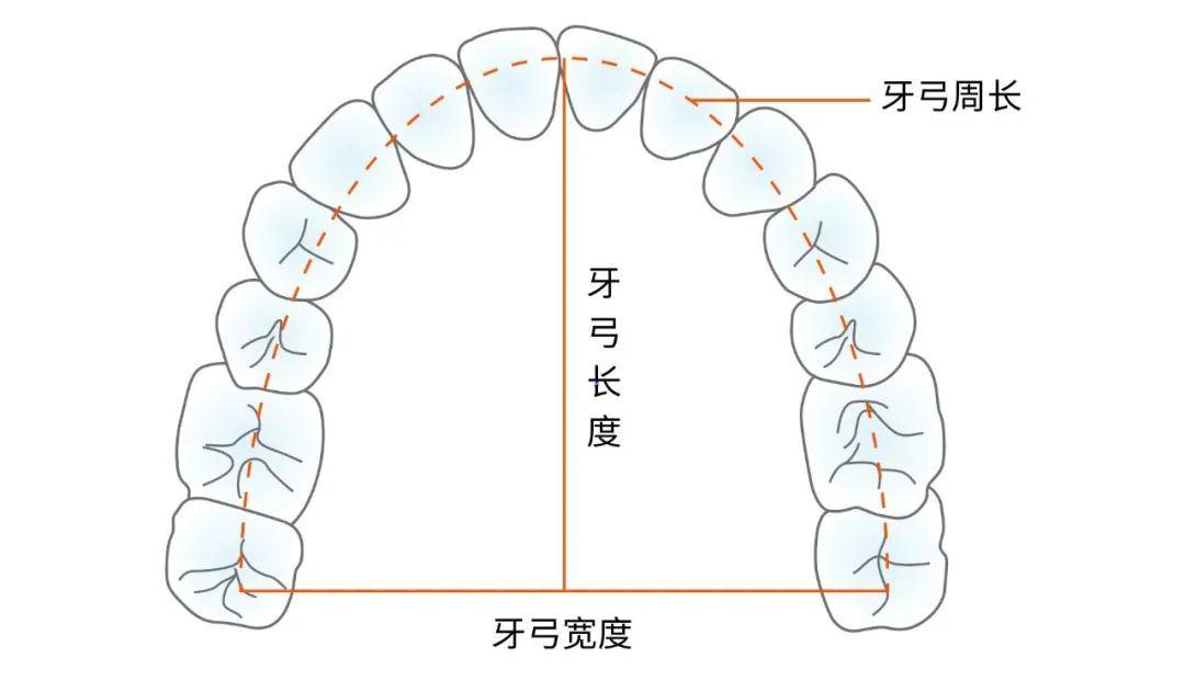 牙齿拥挤错位想整牙必须拔牙吗这些知识很重要