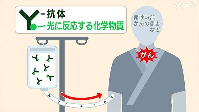 免疫治疗是什么意思有副作用吗 b9f9291e05a643ee88ae890bb7ee623c.jpeg