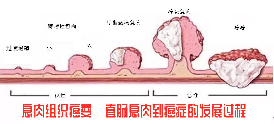 a5f75dca3716421698f4fec4a541bbd8.jpeg