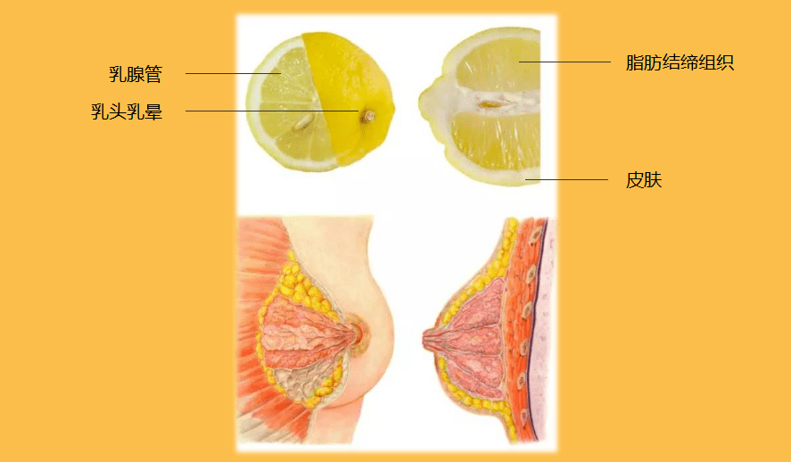 乳腺癌已成为全球最常见的癌症如何早发现乳腺癌变