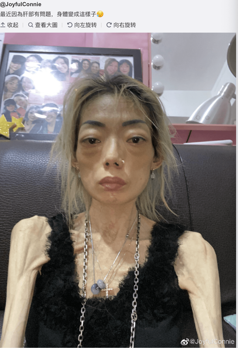 前妻罕露脸精神尚可,仍暴瘦如柴,靠拍卖名牌赚钱筹医药费_伍智恒