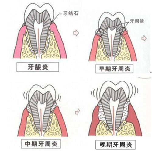 什么是骨骼和牙齿的重要组成部分 91c7a49b62d24b27957f2a7c41bdfd8f.png