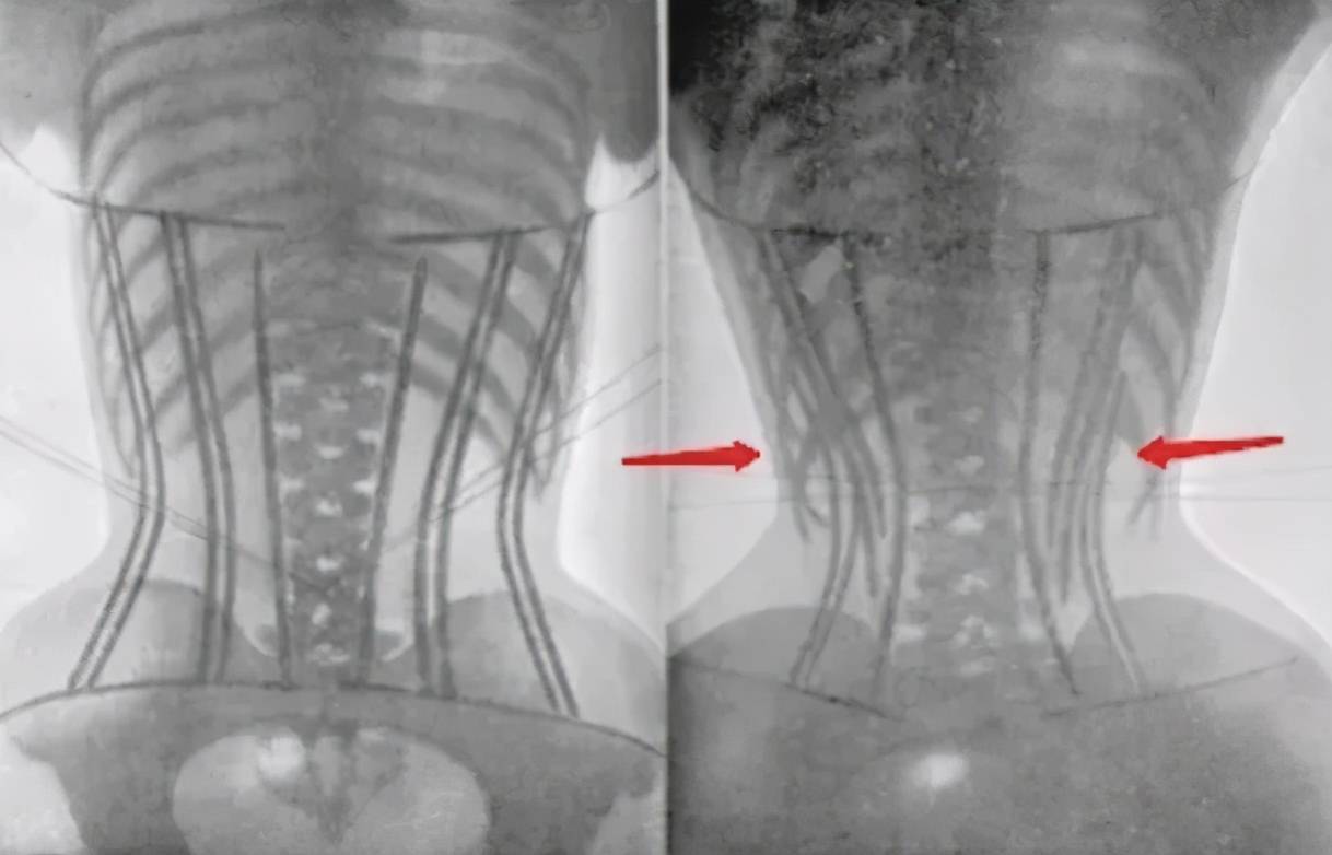 如何快速长高不伤骨骼 9efabe0abbe64f00ac68fa93d5b34b23.jpeg
