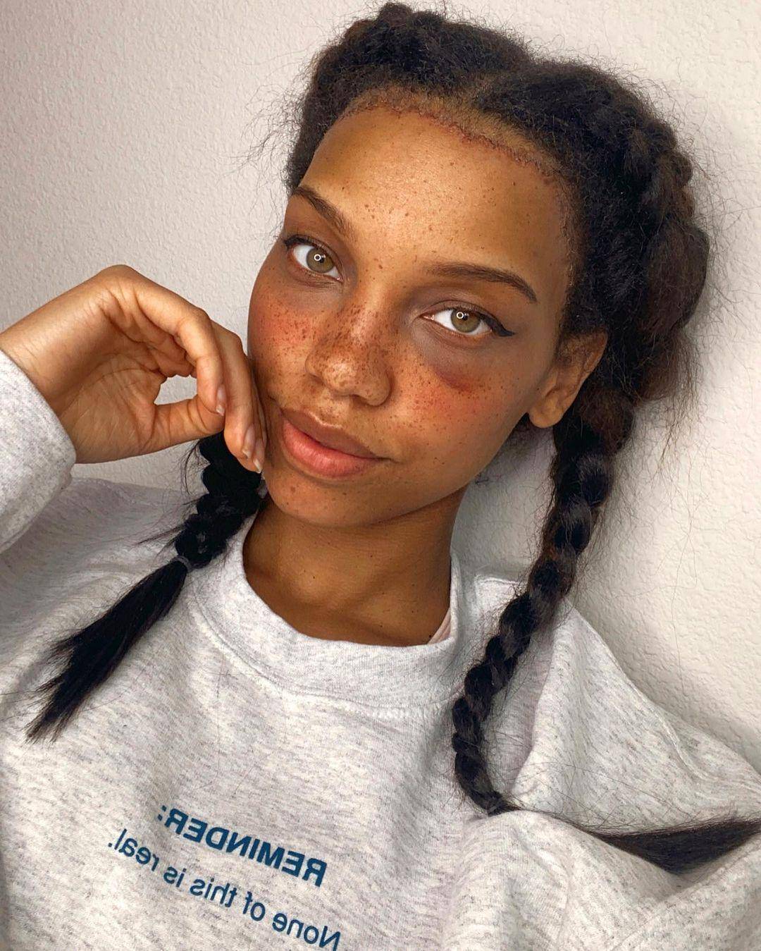 5万变短3厘米,脸上留疤也甘愿_布鲁克斯