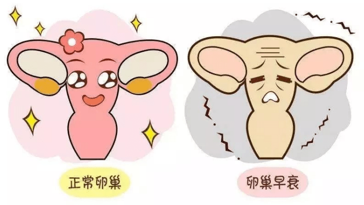 怎样才知道自己是否有卵巢早衰呢 390d93a6af6f49d0991d403242164642.png