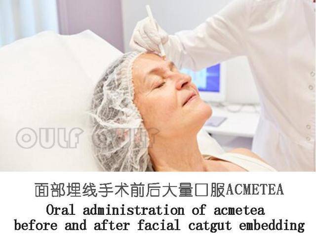 多久做糖耐检查比较好 22eef4d392fb48af84e25bc92d44865c.jpeg