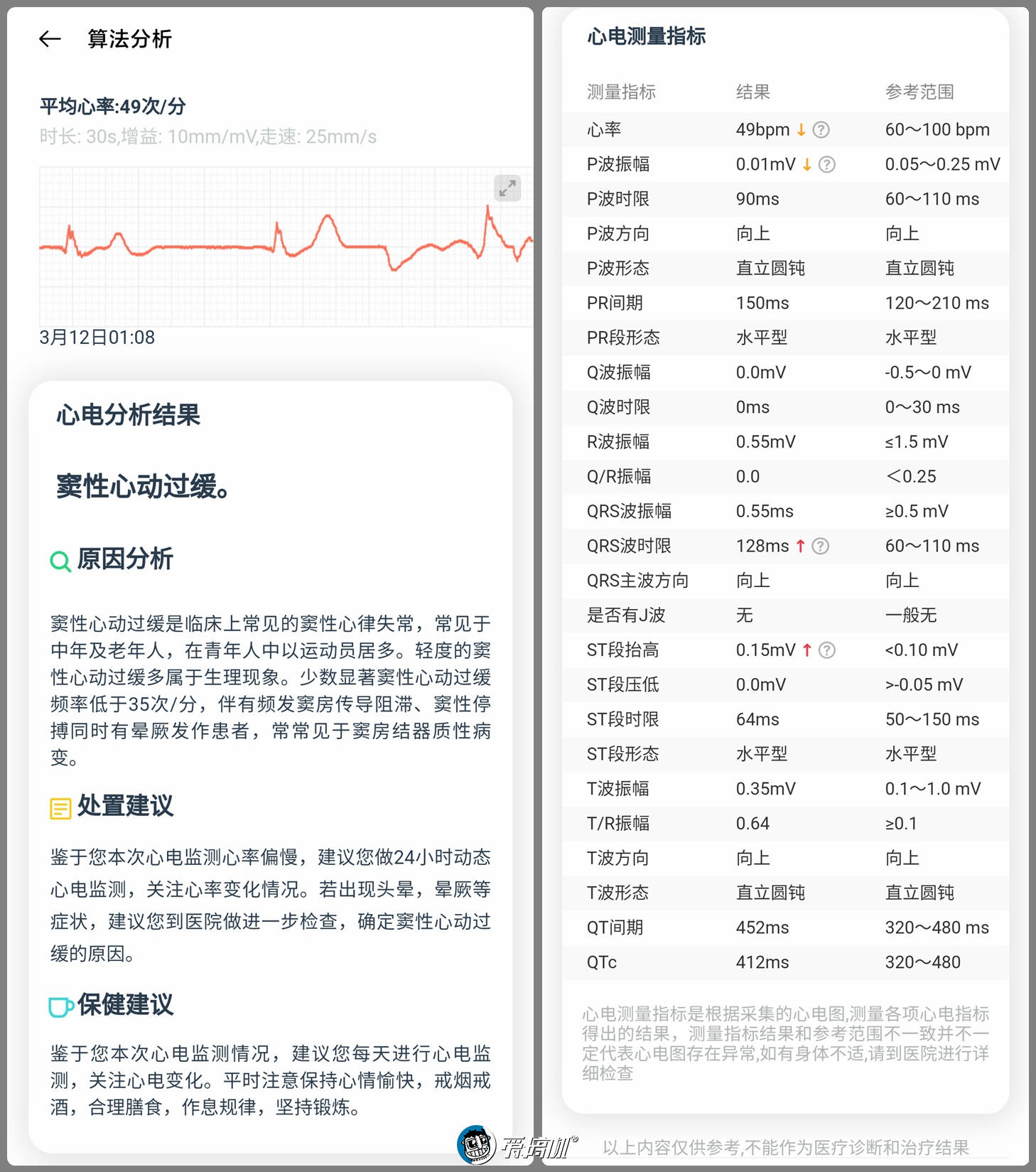 评测|用了大半年以后,OPPO Watch ECG版评测