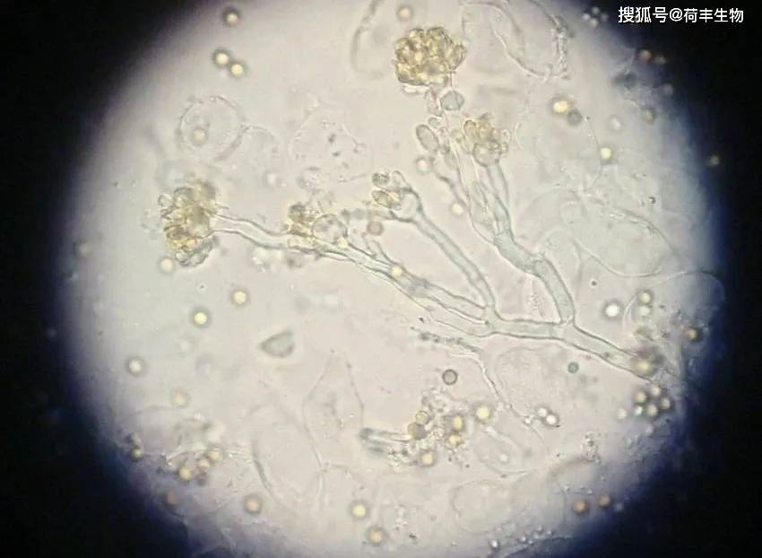 青霉菌大小图片
