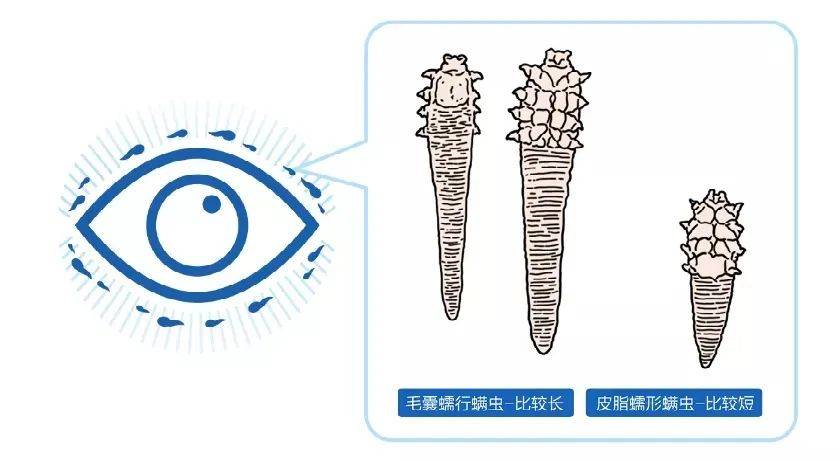 怎么判断眼睫毛有螨虫图片