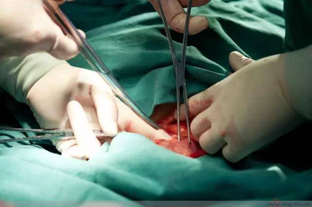做一台手术会用到这么多的剪刀和夹子.先用纱布把伤口堵住.