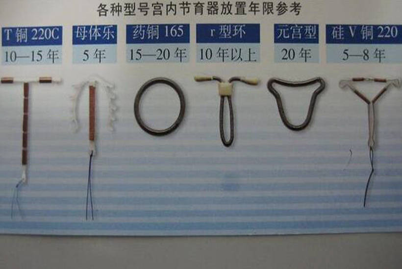 52岁大妈上节育环后,超20年未取,此刻在体内发