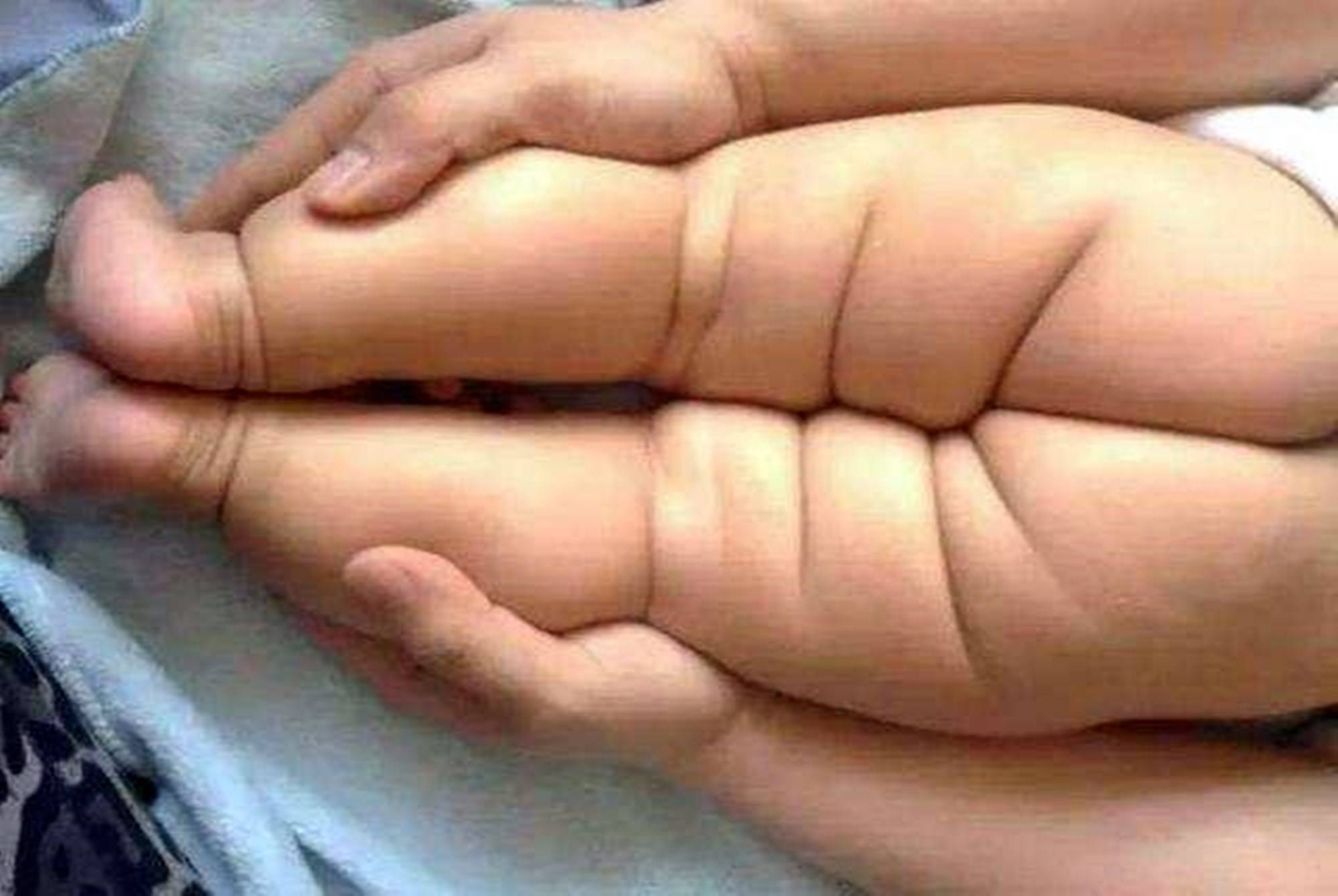 宝宝腿短图片 七个月宝宝腿短