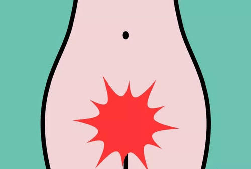 潮热的季节马上就要来了,讨厌的瘙痒又要来了