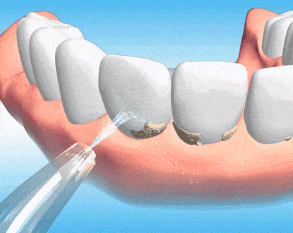 415_330gif 动态图 动图