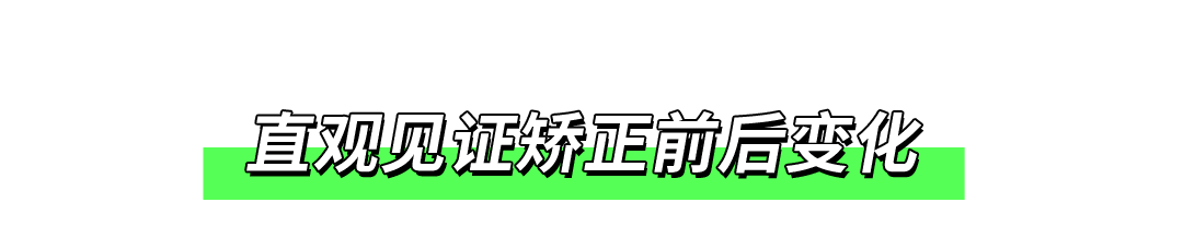 牙齿|超强素人改造！拯救「牙不齐星人」10个月，完美蜕变！