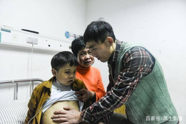 河南7歲男孩患重病肚子腫大如球,父親:不想放棄孩子