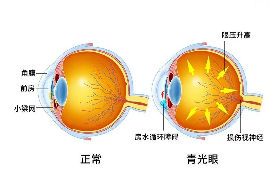 眼球转动视线模糊_转动眼球能恢复视力吗_眼球转动训练能治疗近视吗