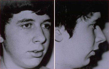 研究表明:长期用嘴呼吸的人,相貌会变丑!_面容