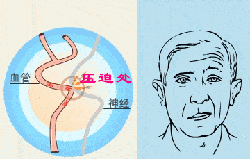 ba7adb29db434dc490cc86d929f5d7b5.gif