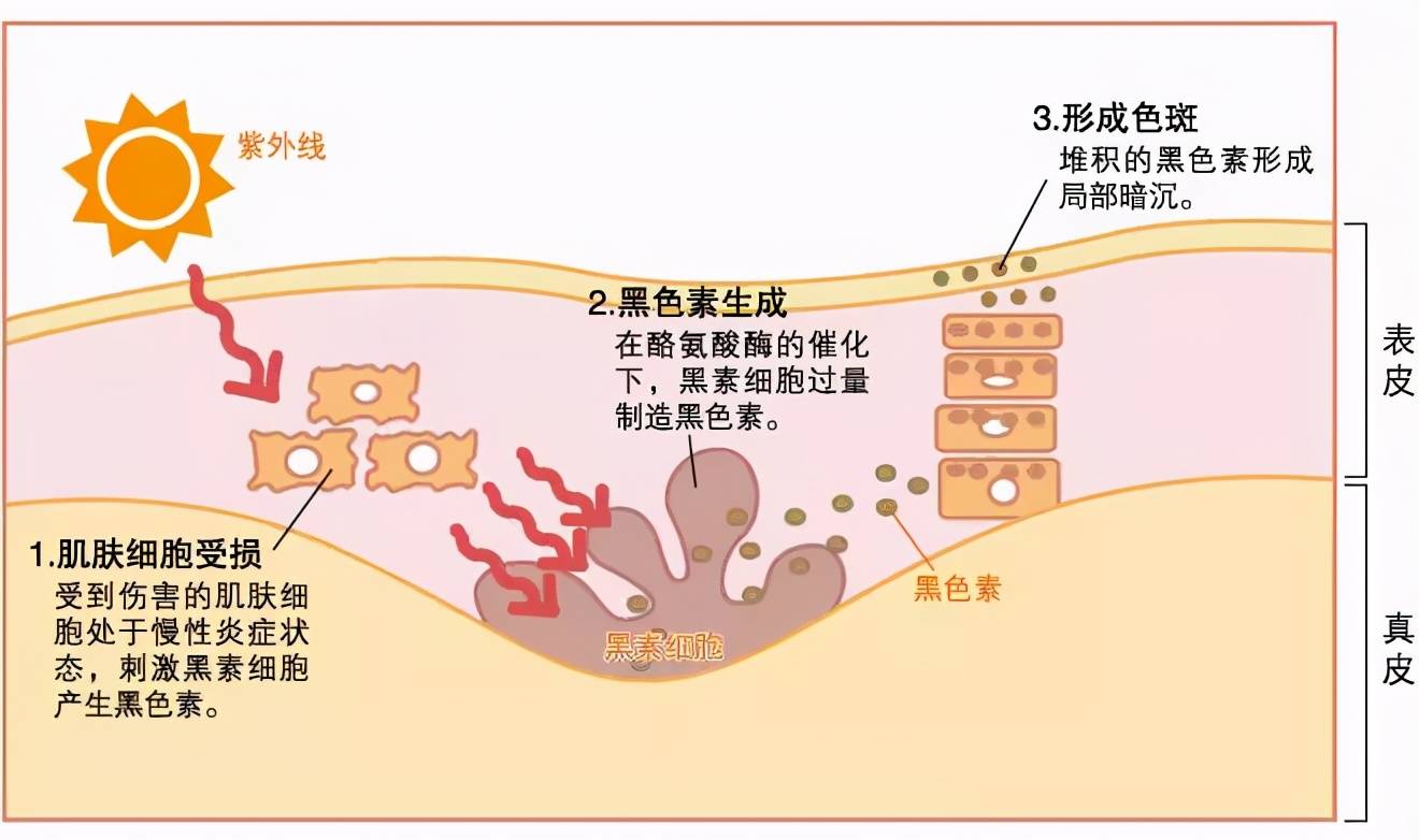 【未来医生】不想变黑,除了防晒,还应该这样做
一 我们为什么会变黑?二 想要不变黑需要注意什么?