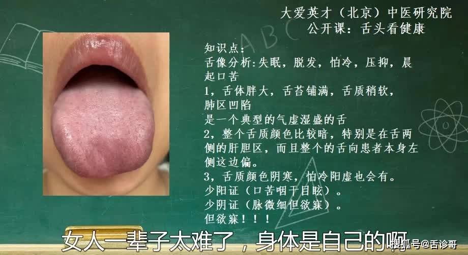 舌象分析胸悶氣短失眠脫髮提示體內氣虛溼盛