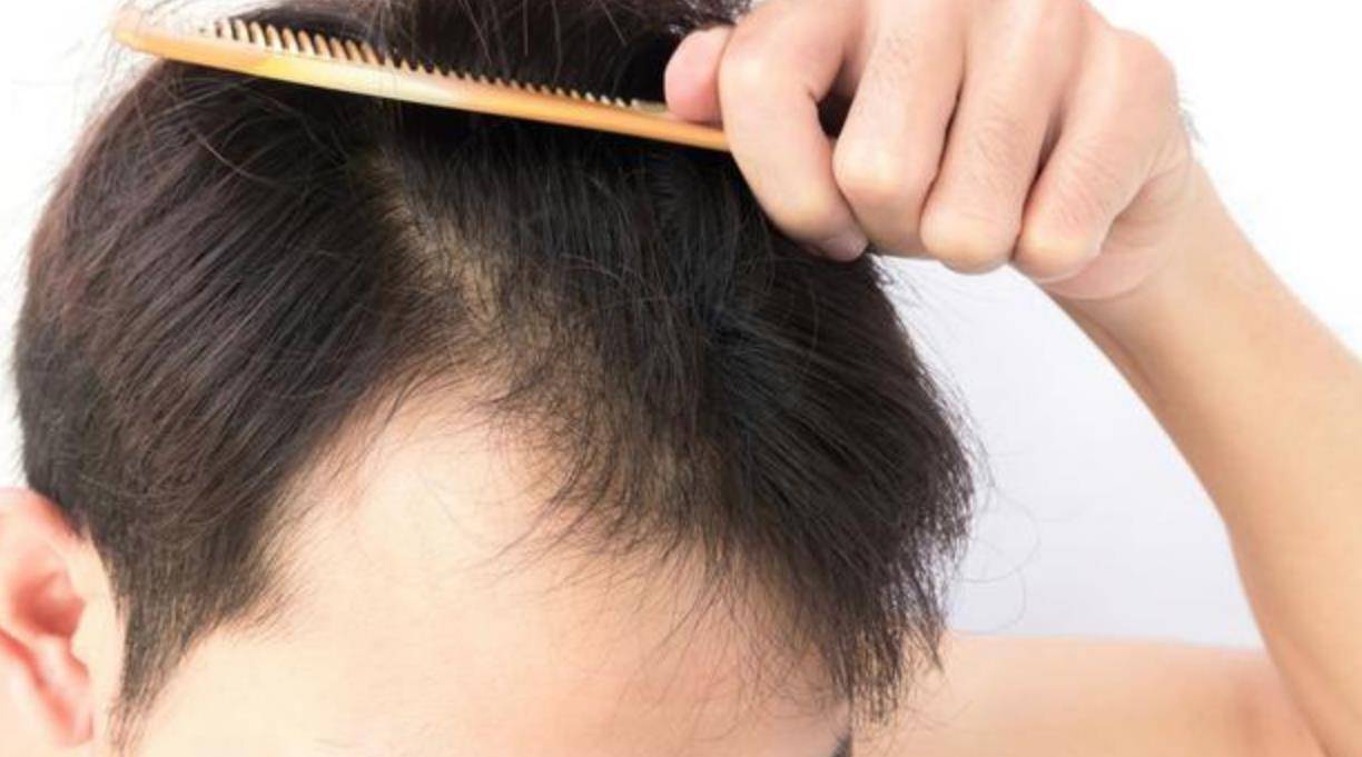 生姜治脱发有科学依据吗--生姜治脱发是什么原理