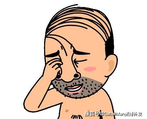 原创第一批00后开始脱发了你的发际线没事吧