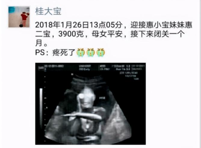 下面这位也不甘示弱,这位爸爸在喜得千金后,直接ps了一张奥特曼的b超