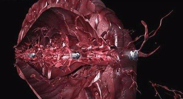 子弹为什么能够打死人?这几张图告诉你答案_人体