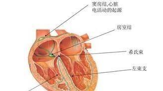 心脏血管堵塞70%必须做支架吗 dd330b1c0f50424fb4720afec9c9e9c9.jpeg