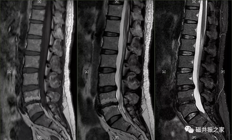 这些腰椎病变都不知道你还敢说你是技术界的老司机