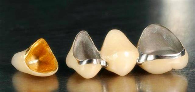 用什么方法可以把烤瓷牙取下来 bd114e476e21444c91670e24b86e5559.jpeg