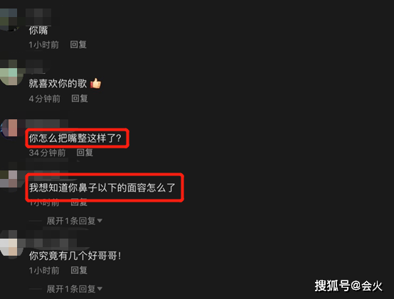 51岁孟庭苇皮肤白皙不见皱纹,网友:嘴怎么了?