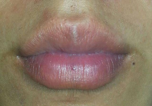中医教你如何从唇色 读出 健康状态 4种唇色代表着不同的问题 嘴唇