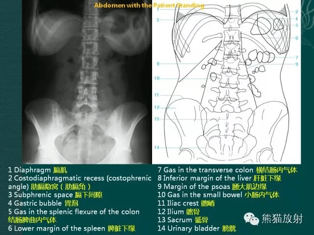 胸,腹部x線讀片小技巧,一定要收好!