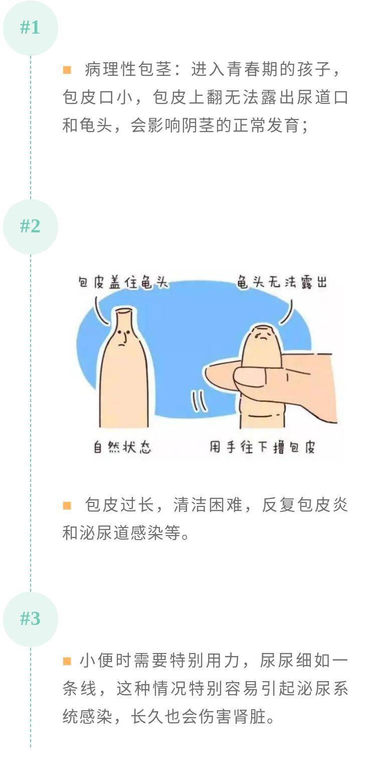 包茎自翻的步骤假性包茎自翻教程图解 自媒体热点