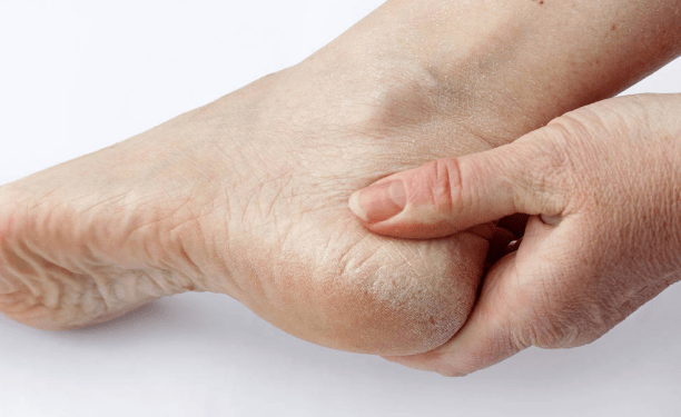 年轻人|肝不好的人,脚部或会有4个异常,若一个也没有,值得祝贺