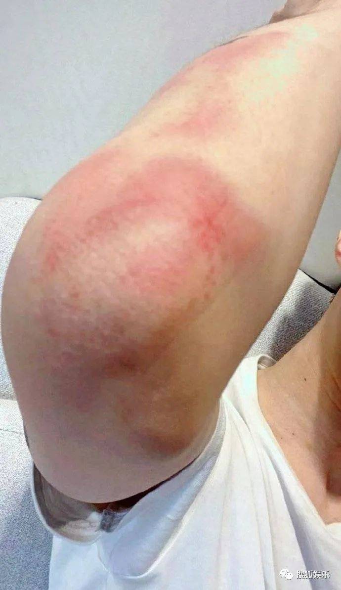 原创娱乐日报|布兰妮疑遭父亲虐待;范丞丞拍戏受伤;季冠霖回应周冬雨