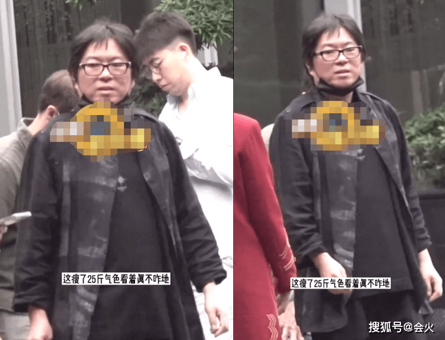 高晓松暴瘦26斤现身街头!脸部松垮挂不住肉